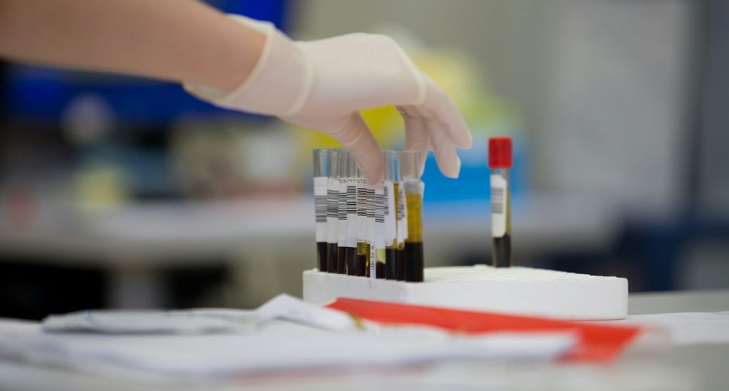 Japan's Bold Leap: Pioneering Artificial Blood Trials Offer Hope for Future Healing