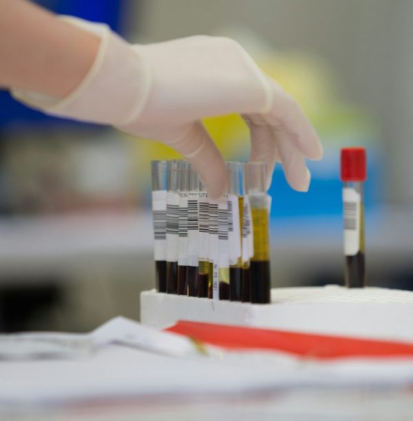 Japan's Bold Leap: Pioneering Artificial Blood Trials Offer Hope for Future Healing