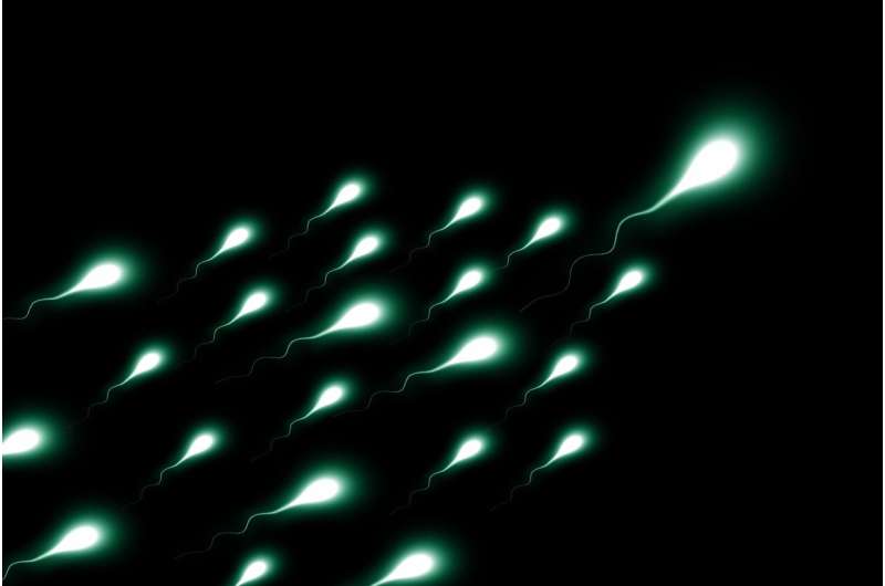 Credit: Pixabay/CC0 Public Domain sperm