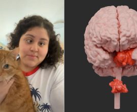 Breaking Boundaries: A Pioneering Procedure That Transformed Lives by Removing Both Limits and Fears