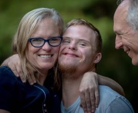 Breaking Boundaries: CRISPR Restores Hope by Correcting Chromosomal Abnormalities in Down Syndrome Lab Models