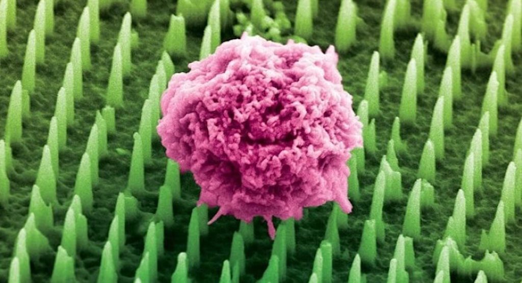 Transforming Pain: Revolutionary Needles 1,000 Times Thinner Than Hair Offer Hope for Gentle Cancer Biopsies