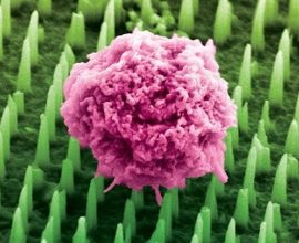 Transforming Pain: Revolutionary Needles 1,000 Times Thinner Than Hair Offer Hope for Gentle Cancer Biopsies