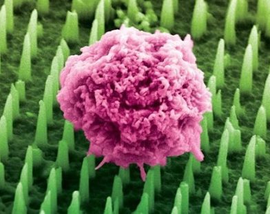 Transforming Pain: Revolutionary Needles 1,000 Times Thinner Than Hair Offer Hope for Gentle Cancer Biopsies
