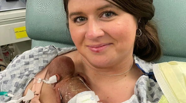 Against All Odds: World’s Most Premature Baby Defies Destiny, Celebrates First Birthday with a New Guinness Record