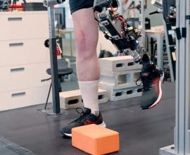 Reclaiming Steps: How a Revolutionary Bionic Knee is Transforming Lives for Lower Leg Amputees