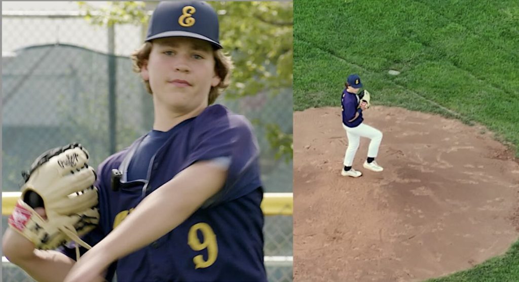 Swinging for Life: How a Groundbreaking Kidney Transplant Preserves a Teen Baseball Player's Passion