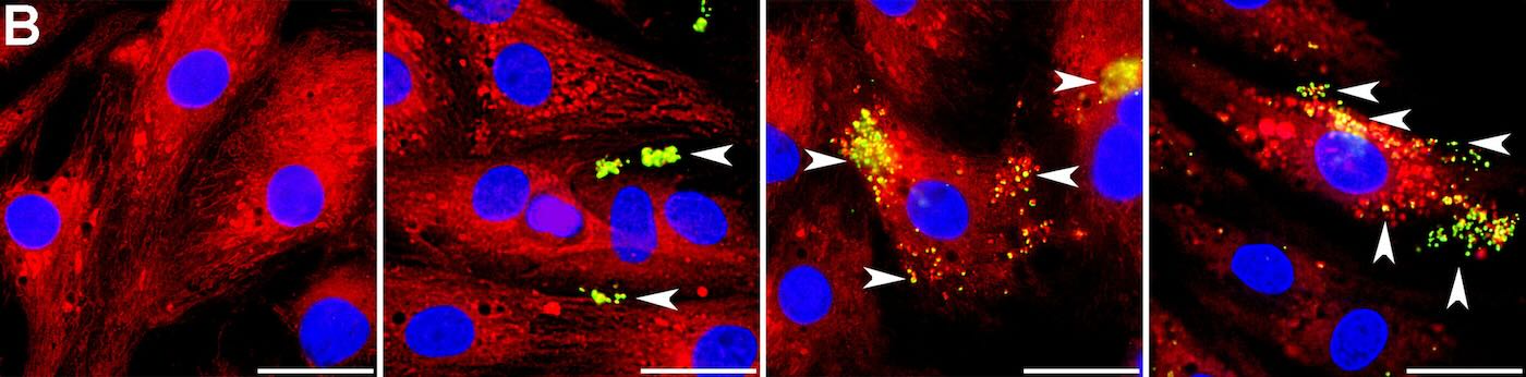 Rat heart cells with mitochondria