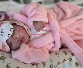 Against All Odds: Tiny Miracle Micro-Preemie Weighing Just 1 lb. 14 oz. Finally Returns Home After 146 Days of Courage and Hope