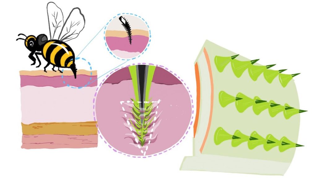 Buzzing Innovation: How Bee Stingers Are Transforming the Future of Comfortable, Continuous Drug Delivery