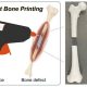 Revolutionizing Healing: The 3D-Printing 'Glue Gun' That Mends Bone Fractures in Real Time, Bringing Hope and Wholeness to Surgery