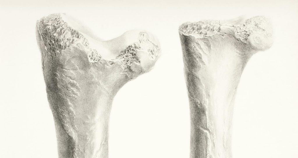 Unlocking Strength: Scientists Discover Game-Changing Switch to Combat Osteoporosis and Empower Aging Bones