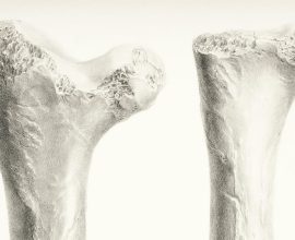 Unlocking Strength: Scientists Discover Game-Changing Switch to Combat Osteoporosis and Empower Aging Bones