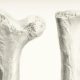 Unlocking Strength: Scientists Discover Game-Changing Switch to Combat Osteoporosis and Empower Aging Bones