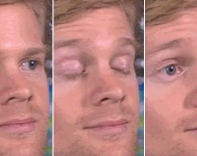 From Viral Fame to Heartfelt Impact: The 'Blinking Guy' Turns Laughter into Love by Paying It Forward