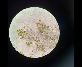 Lost for 130 Years: A Hidden Microscopic Ecosystem Thrives Again in Toronto's Revived Wetlands