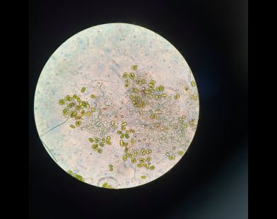 Lost for 130 Years: A Hidden Microscopic Ecosystem Thrives Again in Toronto's Revived Wetlands