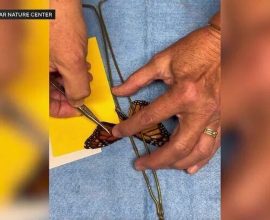 Miracle in the Moment: Millions Tune In as Emergency Butterfly Wing Transplant Inspires Hope and Resilience