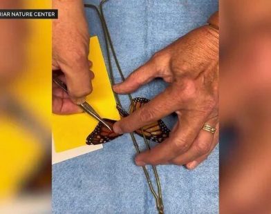Miracle in the Moment: Millions Tune In as Emergency Butterfly Wing Transplant Inspires Hope and Resilience