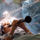 Music in the Moment: Parkinson's Patient Thrills with Clarinet Performance During Groundbreaking Brain Surgery